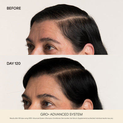 GRO+ Advanced Gel-Serum Pen