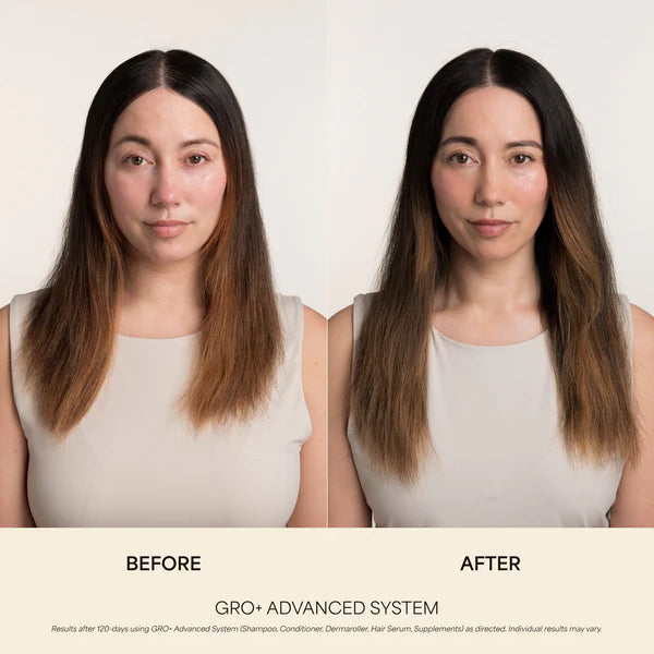 GRO+ Advanced Balancing Shampoo & Conditioner Kit