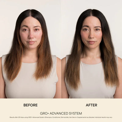 GRO+ Advanced Balancing Shampoo & Conditioner Kit