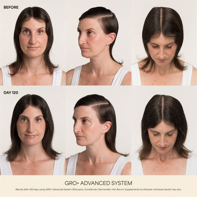 GRO+ Advanced Hair Serum