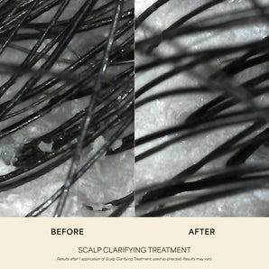 Scalp Clarifying Treatment