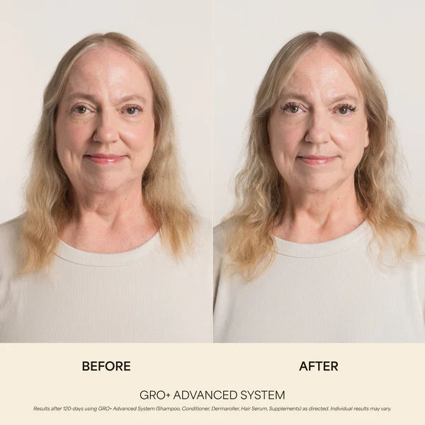 GRO+ Advanced Balancing Shampoo & Conditioner Kit