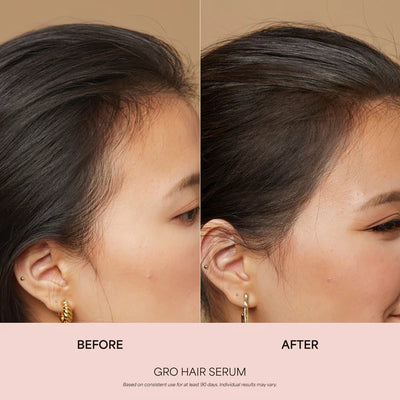 GRO Biotin Gummies for Hair Wellness®